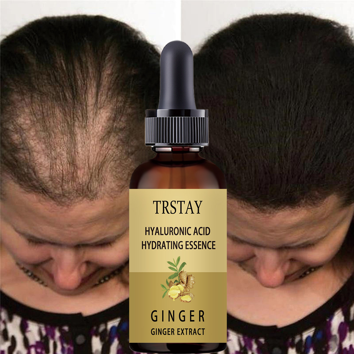 Hair Growth Serum Anti Prevent - đánh giá và giá Caffeine Hair Serum