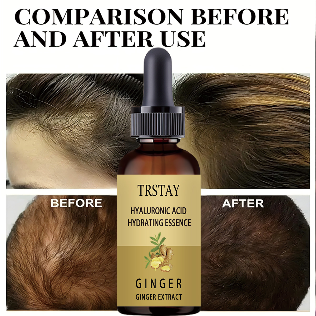 Hair Growth Serum Anti Prevent - đánh giá và giá Caffeine Hair Serum