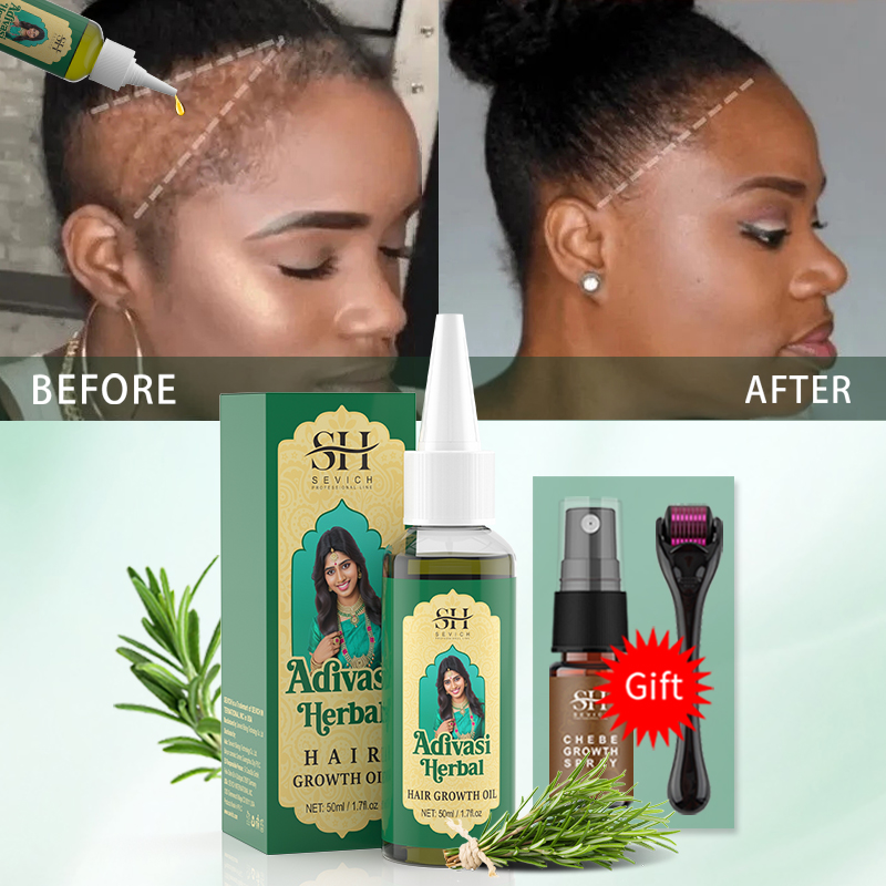 Ayurvedic Hair Growth Oil Indi - đánh giá và giá Caffeine Hair Serum