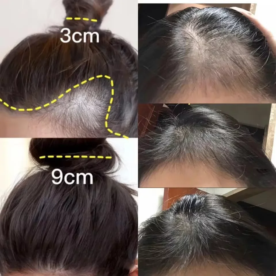 Fast Ginger Hair Growth Cream  - đánh giá và giá Hair Care Dupes