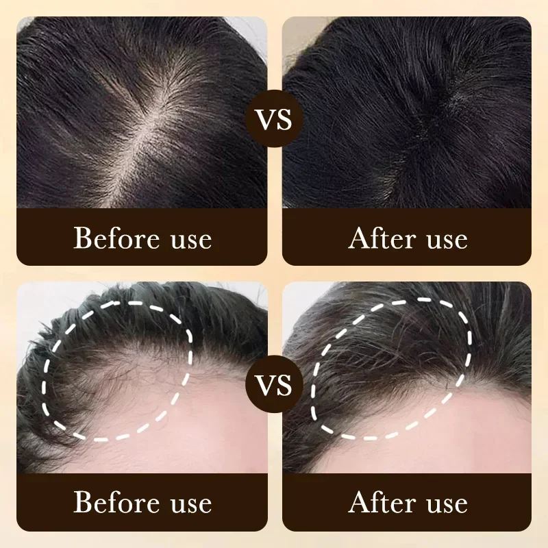 Biotin Fast Hair Growth Oil Pr - đánh giá và giá Caffeine Hair Serum