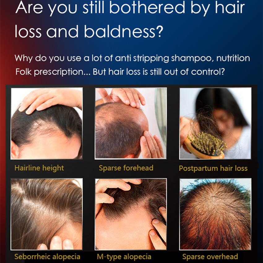 Lông Tăng Trưởng Lược Điện Tăn - đánh giá và giá Hair Care Brand