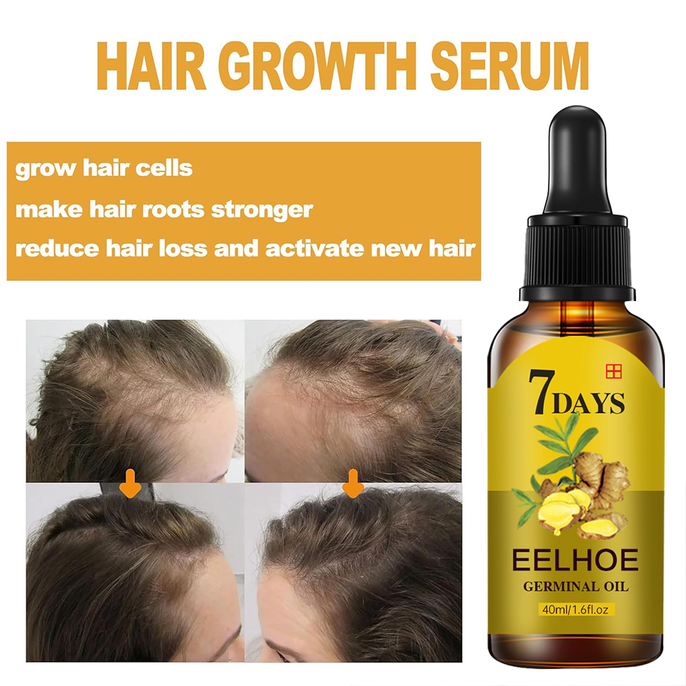 Hair Growth Serum Fast Growing - đánh giá và giá Hair Care Essential Oil Atomizing