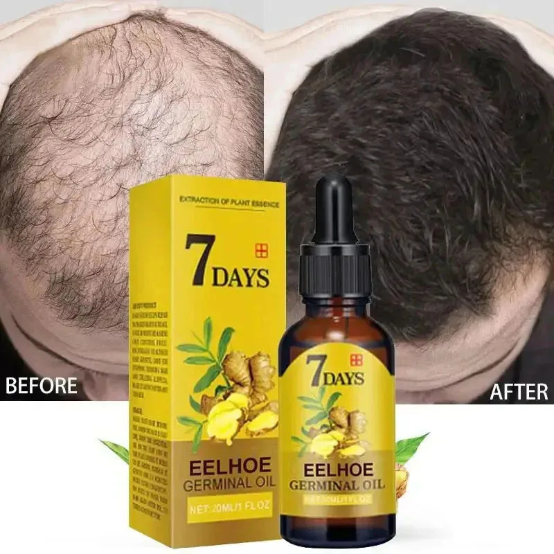 7 Day Fast Hair Growth Serum G - đánh giá và giá Hair Care Essential Oil Atomizing