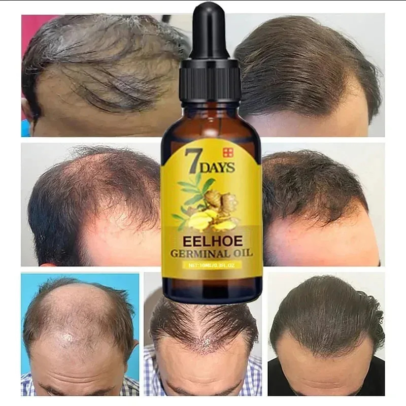 7 Day Fast Hair Growth Serum G - đánh giá và giá Hair Care Essential Oil Atomizing