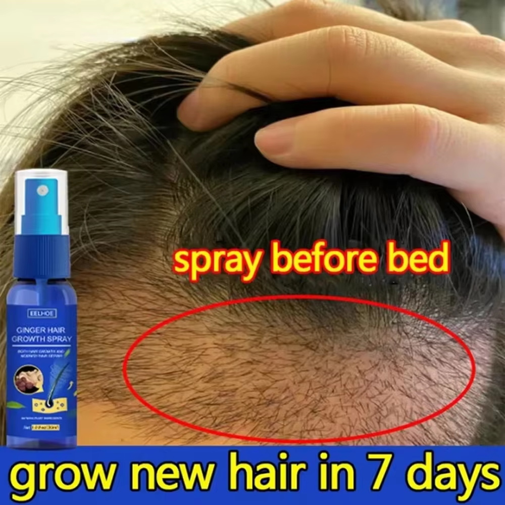 Fast Ginger Hair Growth Spray  - đánh giá và giá Hair Growth Serum Oil