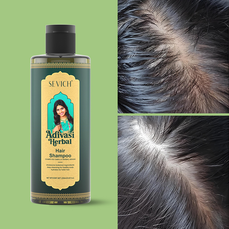 Hair Growth Oil Set Rosemary H - đánh giá và giá Hair Care India